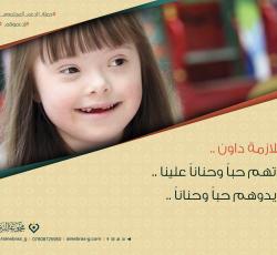 متلازمة داون
