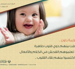 متلازمة داون