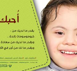 متلازمة داون
