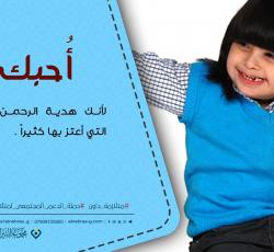 متلازمة داون