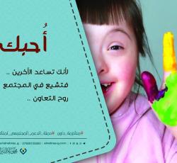 متلازمة داون