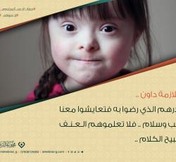 متلازمة داون