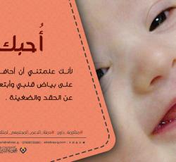 متلازمة داون