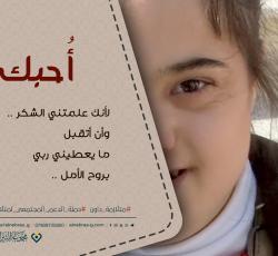 متلازمة داون