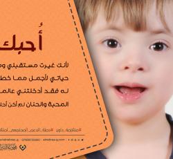 متلازمة داون