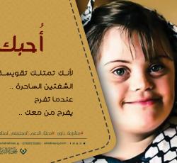 متلازمة داون