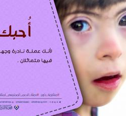 متلازمة داون