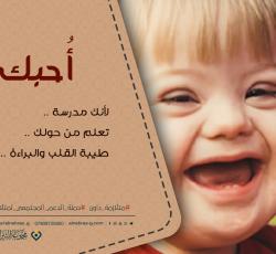 متلازمة داون