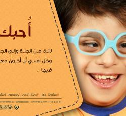 متلازمة داون