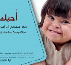 متلازمة داون