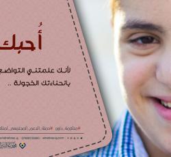 متلازمة داون