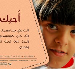 متلازمة داون